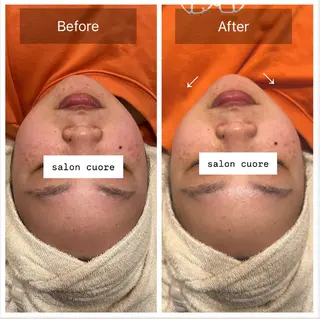 salon cuore豊中服部のエステ・リラクイメージ