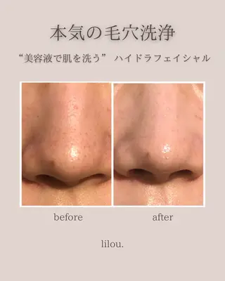 hue.所属・hue. YUKAのエステ・リラクイメージ