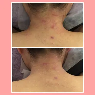 ミディアム カラー パーマ ヘアアレンジ メンズ キッズ ネイル マツエク・マツパ ニキビ・肌質改善専門 ♡人生が変わるサロンのエステ・リラクイメージ