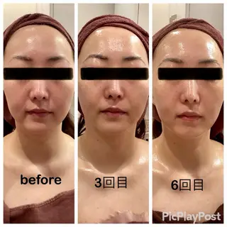 RICHE 【リッシュ】のエステ・リラクイメージ