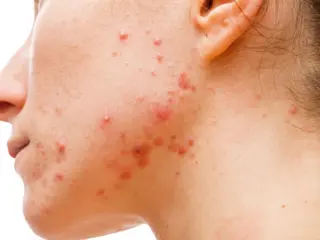 エステサロン pure  mother所属・小林 清美のエステ・リラクイメージ