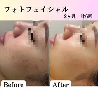 美肌脱毛サロン muroのエステ・リラクイメージ