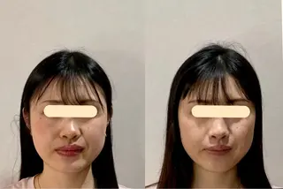 最速小顔・肌質管理 espoirマキのエステ・リラクイメージ