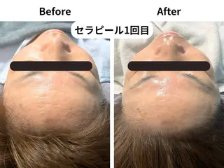 エイジングサロンビー EMIのエステ・リラクイメージ