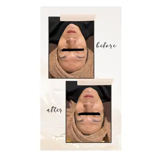 ピーリング＆脱毛 maoのエステ・リラクイメージ