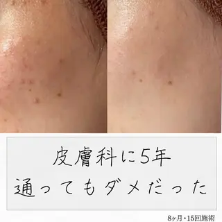 ニキビ経験者が施術 する専門サロン🌻のエステ・リラクイメージ