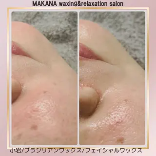 MAKANA waxing&relaxation所属・MAKANA 吉岡 小岩店のエステ・リラクイメージ