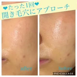 ミディアム カラー パーマ ヘアアレンジ キッズ ネイル マツエク・マツパ EnsorClair 代表 野口真央のエステ・リラクイメージ