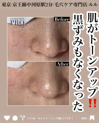 LULU ルルのエステ・リラクイメージ