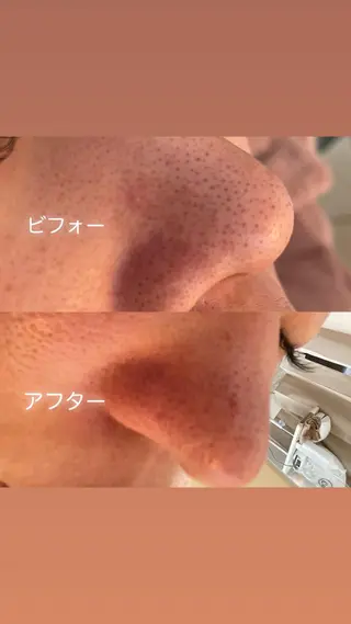 VERY VERY 九条店のエステ・リラクイメージ
