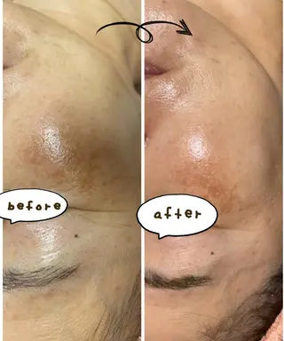 EYE LASH LAPISのエステ・リラクイメージ