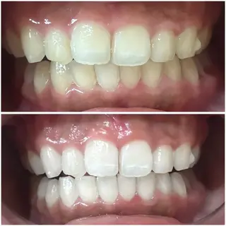 脱毛・ホワイトニング 耳ツボ・美白・毛穴のその他イメージ