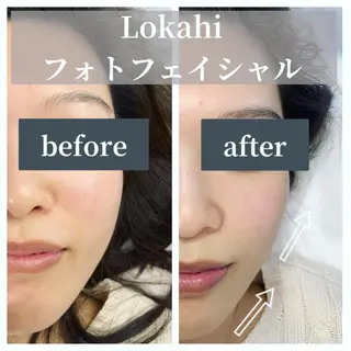 脱毛サロン Lokahiのエステ・リラクイメージ