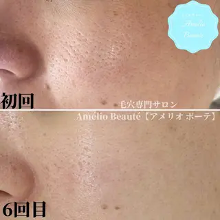 毛穴ケア専門サロン アメリオボーテのその他イメージ