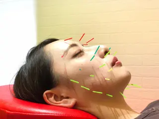 🌈 肌質改善 美容鍼🙌イイダ🌈のエステ・リラクイメージ