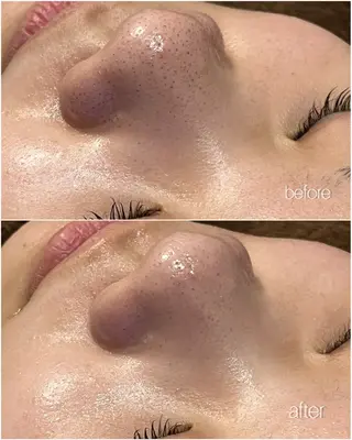 ENCHANT Kaede/肌質改善のその他イメージ