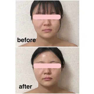 カイロプラクティックグッドパートナー所属・🦴一柳きらら🦴 骨格調整の専門家のエステ・リラクイメージ