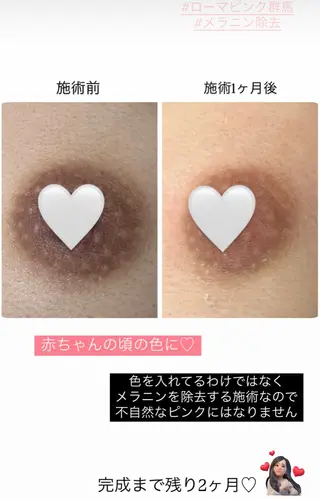 Raviy 【痩身専門・肌管理】のエステ・リラクイメージ