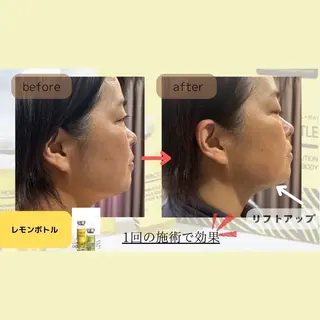 ﾌﾟﾗｲﾍﾞｰﾄｻﾛﾝ アンクチュール所属・UnCouture 〜アンクチュール〜のエステ・リラクイメージ