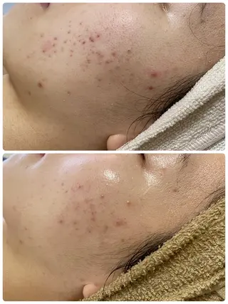 COCO beautyサロンのエステ・リラクイメージ