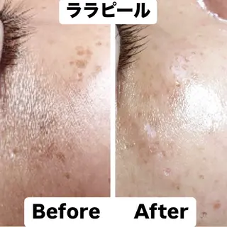 小西 綾香のエステ・リラクイメージ