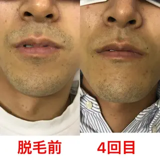 メンズ メンズ脱毛サロン ／金山昌弘のエステ・リラクイメージ