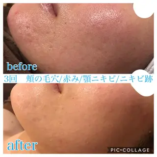 ショート カラー パーマ ヘアアレンジ メンズ キッズ ネイル マツエク・マツパ EnsorClair 代表　野口真央のエステ・リラクイメージ