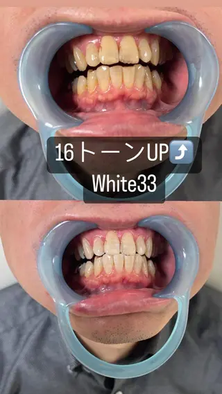 メンズ セルフホワイトニング White33大名のその他イメージ