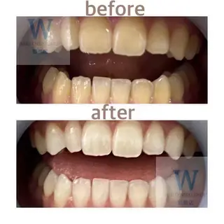 ホワイトニング ショップ船橋２号店のエステ・リラクイメージ