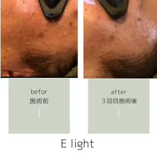 salon mijoaのエステ・リラクイメージ