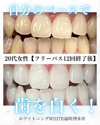 メンズ キッズ セルフホワイトニング WHITE福岡博多店のエステ・リラクイメージ