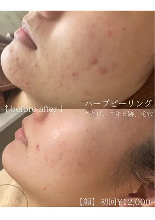 毛穴改善サロン d'Alba大阪住吉のエステ・リラクイメージ