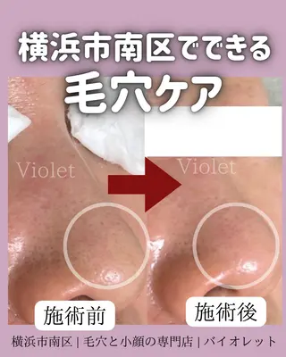 毛穴と耳つぼ専門店 バイオレット　りののその他イメージ