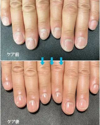 ネイル Nail koko∞Linkのネイルデザイン