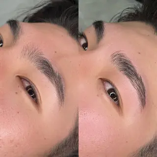 メンズ アイブロウ 脱毛サロンHUGME 光フォトフェイシャルのエステ・リラクイメージ