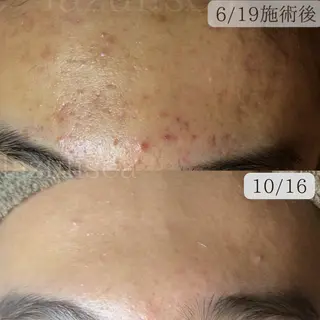 エステサロン Lazulisea所属・川口 春奈のエステ・リラクイメージ