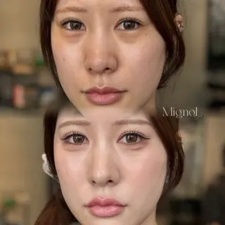 yuri | 韓国垢抜け🌙のその他イメージ