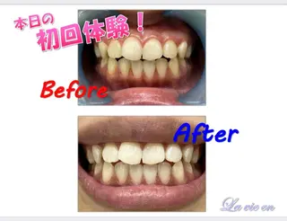 ホワイトニングサロン La vie enのその他イメージ