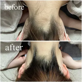 crescent所属・【韓国肌管理・脱毛】 クレセントのその他イメージ