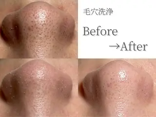 本町オールハンド リラク/女性専用💐のエステ・リラクイメージ