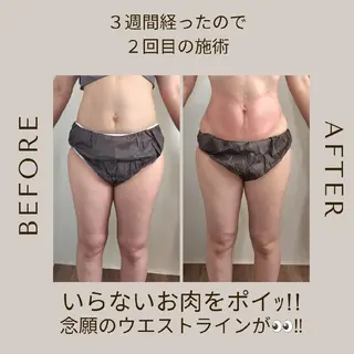 脂肪冷却・脱毛サロン coconoix のエステ・リラクイメージ