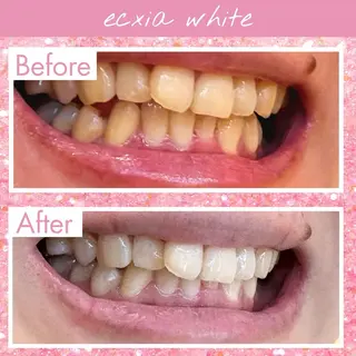 セルフホワイトニング エクシア伊勢店のその他イメージ