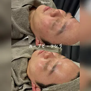 心斎橋🤍堀江.小顔 ハーブ.痩身クレビアのエステ・リラクイメージ