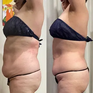 Cherie Tokyoのマツエク・マツパデザイン