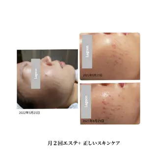 脇山 千佳のエステ・リラクイメージ