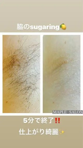 MARI シュガーリストのエステ・リラクイメージ