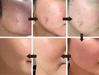 美肌ケアサロン iru【アイル】のエステ・リラクイメージ