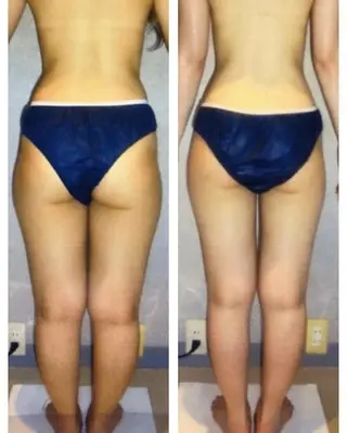 セラピエール 梅田店のエステ・リラクイメージ