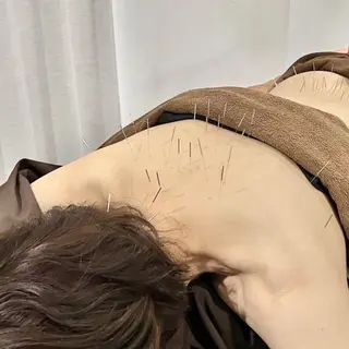 Spring鍼灸院 ✨首肩こり、腰痛に！のその他イメージ
