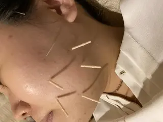 むくみたるみ専門☆ 美容鍼・小顔矯正のエステ・リラクイメージ